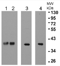 eEF1B-beta1 and 2 | elongation factor 1-beta1 and 1-beta2 in the group Antibodies Plant/Algal  / DNA/RNA/Cell Cycle / Translation at Agrisera AB (Antibodies for research) (AS10 677)